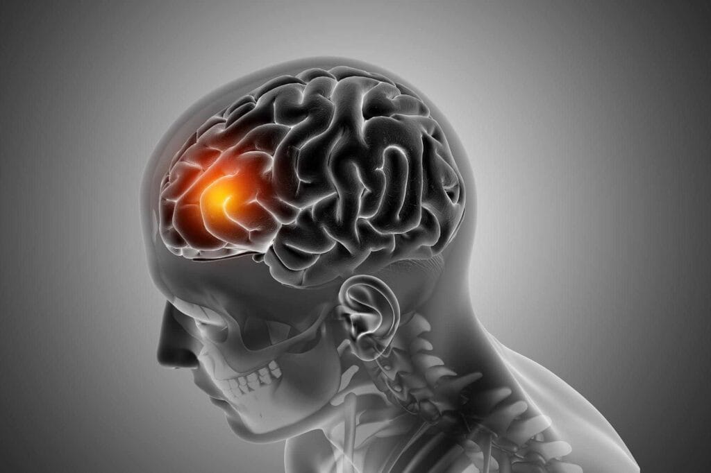 New Research Found That Gut Bacteria Causes Depression Instead of Brain Chemistry 2 Bacteria Causes Depression