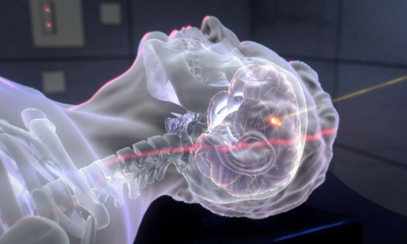 Scientists Beam Light Through a Human Head for the First Time—Rewriting What We Know About Brain Imaging 2 Beam Light Through a Human Head
