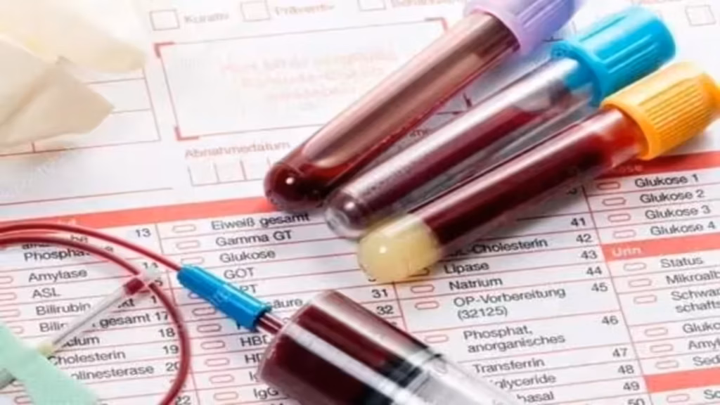 How Your Blood Type Could Influence the Risk of Having a Stroke Before Age 60, According to New Research 2 Blood Type