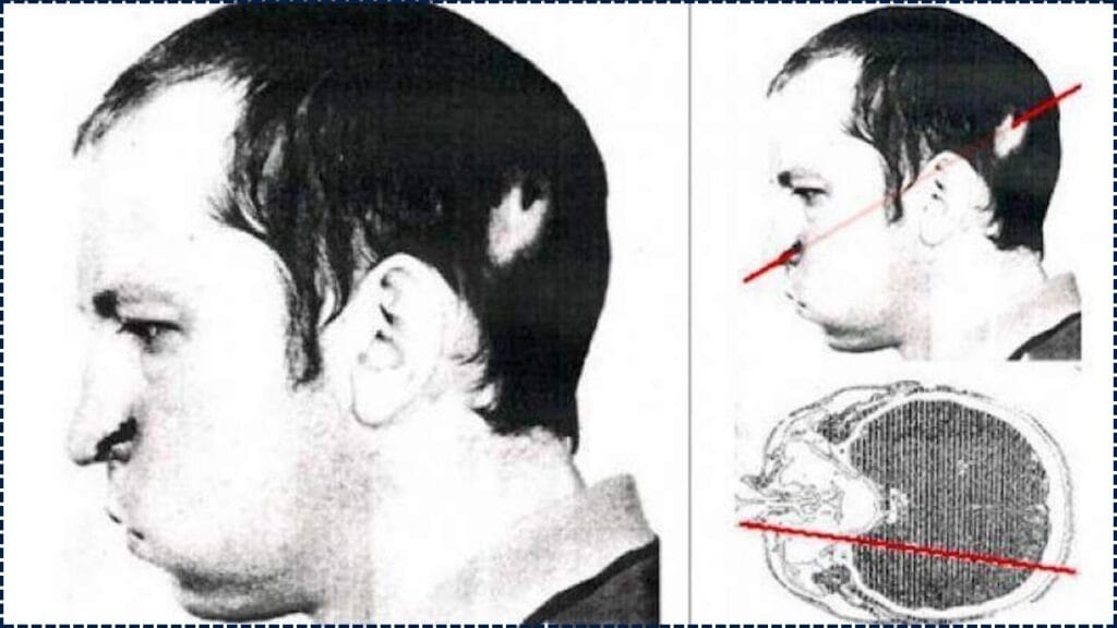 Scientists Beam Light Straight Through a Man’s Head for the First Time in History, and What They Found is Strange 1 Scientists Beam Light Straight Through a Man’s Head