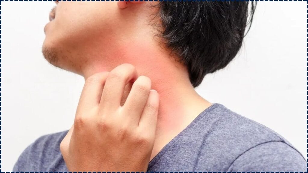 Six Visible Skin Symptoms Including Dryness May Indicate A Vitamin D Deficiency According To Experts 1 Six Visible Skin Symptoms Including Dryness