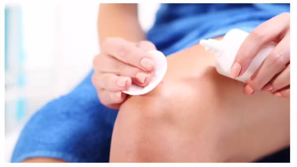 Six Visible Skin Symptoms Including Dryness May Indicate A Vitamin D Deficiency According To Experts 2 Skin Dryness